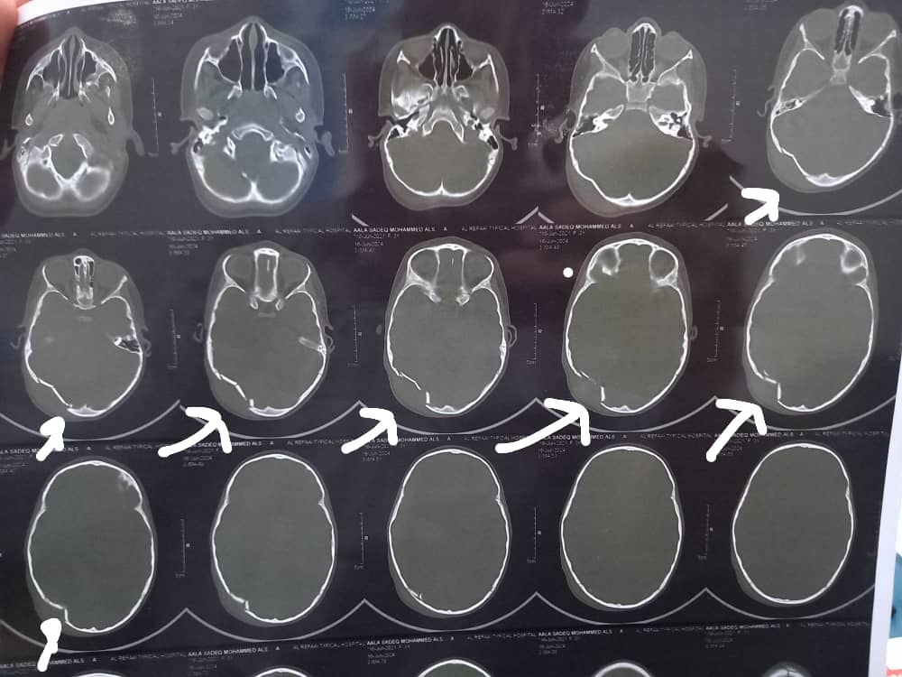 
		تفاصيل جديدة يوضحها مستوصف النخبه بشأن  الطفلة آلاء صادق