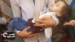 
		ليست السعودية .. دولة عربية تحرق قلوب اليمنيين وتقوم بتعذيب نساء وأطفال يمنيين وترحيلهم 