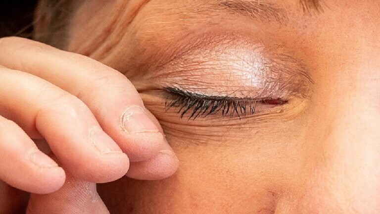 
		عالمة بريطانية: التهاب ملتحمة العين ربما أحد أعراض متحور "أوميكرون"