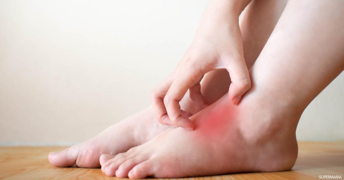 
		احذر.. حكة القدمين المستمرة علامة تحذيرية لمرض خطير لاعلاج له